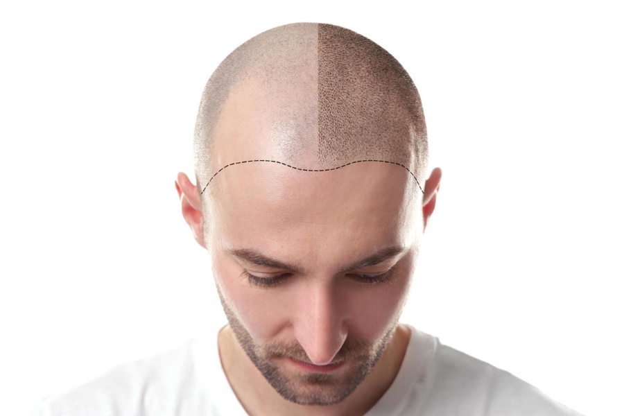 head tattoos for men 0045